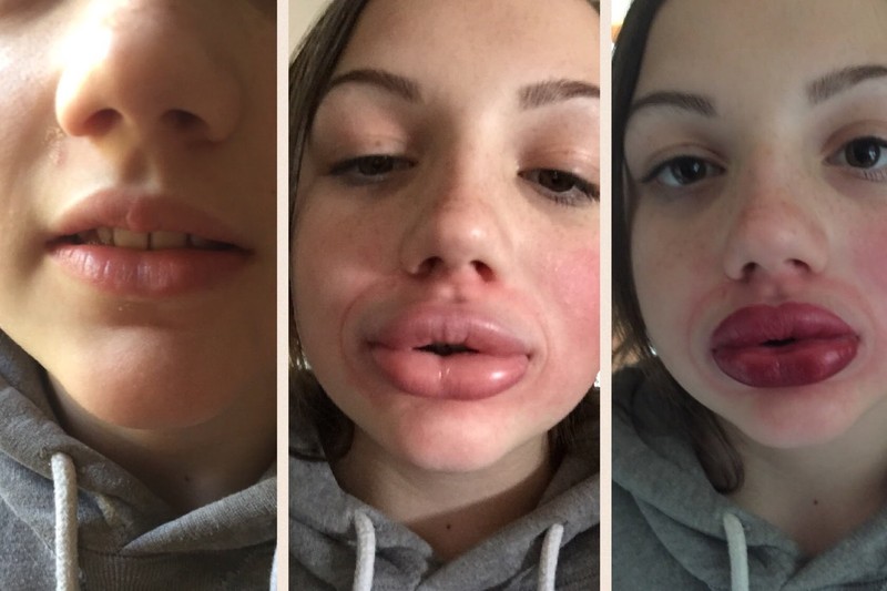 Paris recomended kylie jenner lips