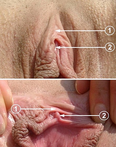 Number S. reccomend prepubital vulva